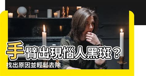 手臂長黑斑